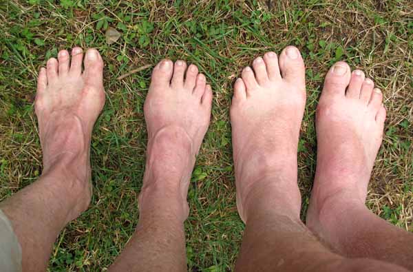Walking in France: A beautiful sight - four blister-free feet at the end of our walk